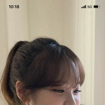 김채원 코 <b>필러</b> 맞은거맞지?