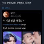 오른쪽 <b>찬열</b>임??