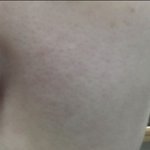 [드루와] 모공 진짜 좋아지지 않음?