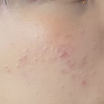 얼굴에 이거 뭐야??????
