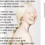 아기 때 버려졌던 알비노 소녀의 인생<b>역전</b>