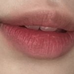 [댓글부탁해] 나 입술 <b>필러</b>맞은거같음?