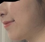 나도 무턱이야??