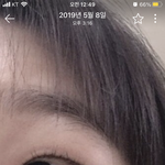 [댓글부탁해] <b>점막</b>이 두꺼운 눈 ㄹㅈㄷ