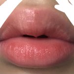입술 부었오 거의 <b>유아</b>