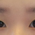 <b>쌍수</b> 고민 8년째 입니당..