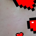 [댓글부탁해] 드디어 피부 복구했다 쉬이이미<b>이바</b>