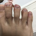 나보다 <b>발톱</b> 못생긴 사람(혐주의)