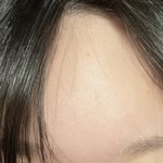 [댓글부탁해] 나보다 <b>이마</b> 넓은사람 있냐