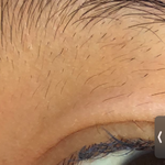 얘들아 나 <b>눈알</b>에 상처남