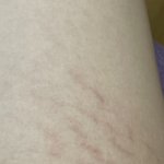 <b>한달전쯤</b>부터 다리에 이런 게 생기는데