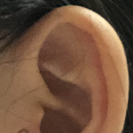 나 <b>트라</b>거스 뚫은지 일주일 됐는데