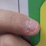 와 나도 <b>손톱</b> 물어뜯었었던 때가 있었네