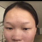 <b>미용</b>성형은 악마의 기술이다