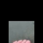 [19] 손이랑 발 유독 빨간 애 있냐?