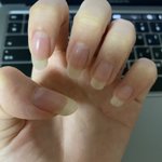 내 <b>손톱</b> 많이 지저분해 보여??