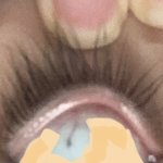 내 <b>눈알</b>에 이상한게 있음 (놀람주의)