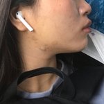 [댓글부탁해] 하관 이렇게 생겼는데 어떻게 해야할까