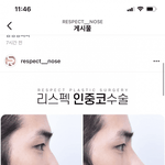 헐 그 에오에 <b>민아</b> 인스타에 올라왔던 남자 코성형