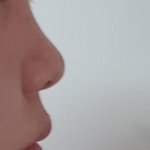 나 <b>돌출입</b>이나 주걱턱일까?