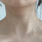 나 승모근 좀 봐주라