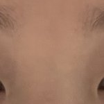 <b>이</b> <b>눈</b>에 쌍수 어때