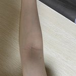 얘두라 나 팔 어떡해