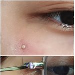 [드루와] 혐주의) 내 초-왕여드름 농익은거 ㅈㄴ귀<b>엽당</b>