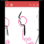 [댓글부탁해] 엥 이게 <b>무턱</b>임 ???