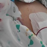 [개깊은빡침] 피해자의 치료 불가능한 현행 자동차 관리법을 개정...