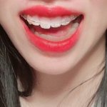 나 안면비대칭 ㄹㅇ심하다...
