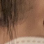 [드루와] 너네가 나라면 쌍수할거야?