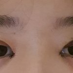 [댓글부탁해] 애드라... 나쌍수했는데 <b>짝짝이</b>로 될까..??ㅠㅠ...