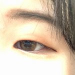 <b>짝눈</b> 쌍수 성공할까...?