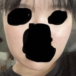 얼굴형 안면윤곽밖에ㅜ답 없냐