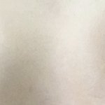 [댓글부탁해] 눈에 <b>지방</b>이 많은편인가????