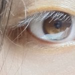 [이것좀봐줘] 쌍수 추반이라도 해줘ㅠㅠ 급해ㅠㅠ