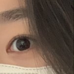 쌍수 <b>전후</b> 개쩐다 ㄹㅇㅋㅋ 레전드