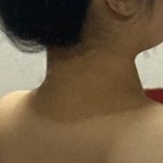 [댓글부탁해] 얘더라 목 뒤에 선크림 잘 바르고 다니자..