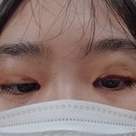 [댓글부탁해] 앞트임 이거원래<b>이래</b>..??