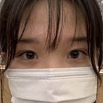 쌍수 후 <b>짝눈</b>인데 재수술 할까말까 ㅠ?