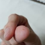 [19] 등<b>드름</b> 뽑았다