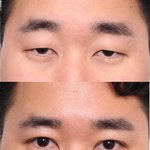 아진짜 남자들 왜이렇게 쌍수하는거? ㅅ.ㅂ
