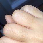 <b>내손</b>보다 징그러운 손 잇음??