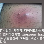[19] 이거 <b>핀셋</b>으로 다 뽑고싶지않냐