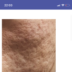 와 피부갤러리 들어갔다가 ㅈㄴ<b>놀람</b>