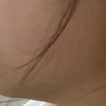 [댓글부탁해] 나 <b>무턱</b>이냐..?