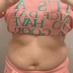 모태통통 지방분해주사 맞고 2주만에 <b>뱃살</b> 13cm 줄었습니다