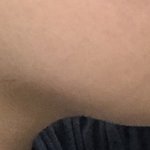 나 <b>무턱</b>이야 ??