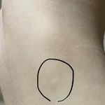 나 화상 흉터 없어질거같아?